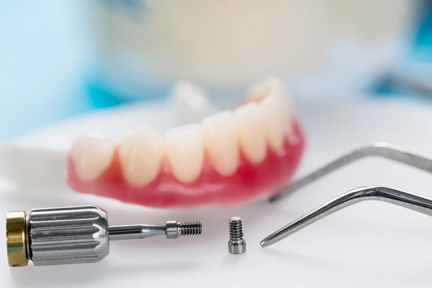Endodoncja stomatologiczna Szczecin