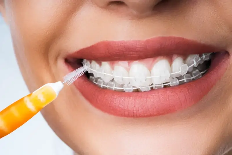 Wybór dobrego dentysty