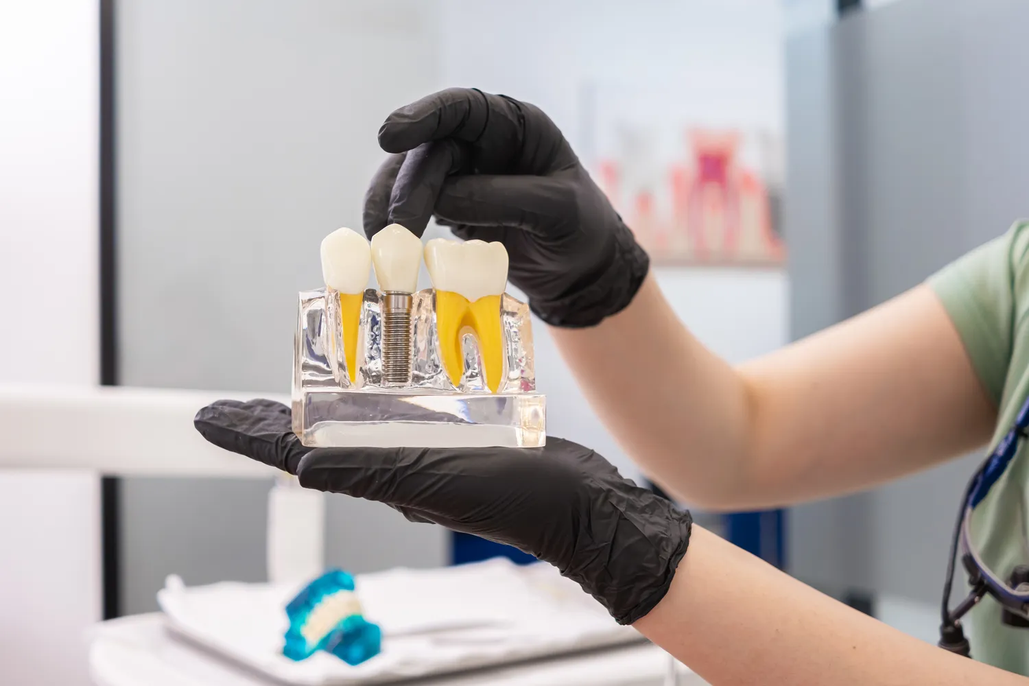 Leczenie kanałowe Wrocław gdzie najlepiej