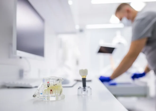 Najlepsze nakładki ortodontyczne Szczecin