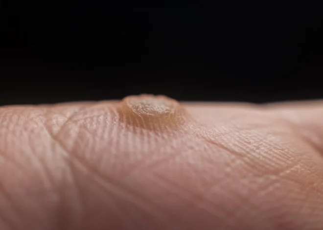 Dobry podolog a zdrowie i komfort stóp