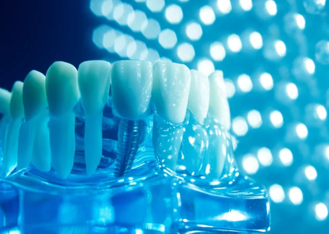 Dr Paweł Dobosz najlepsze implanty Szczecin