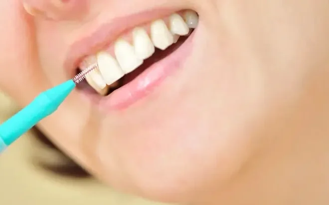 Chirurgia stomatologiczna Warszawa