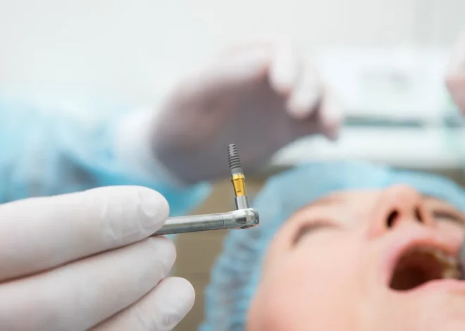 Czy implanty zębów można odliczyć od podatku?