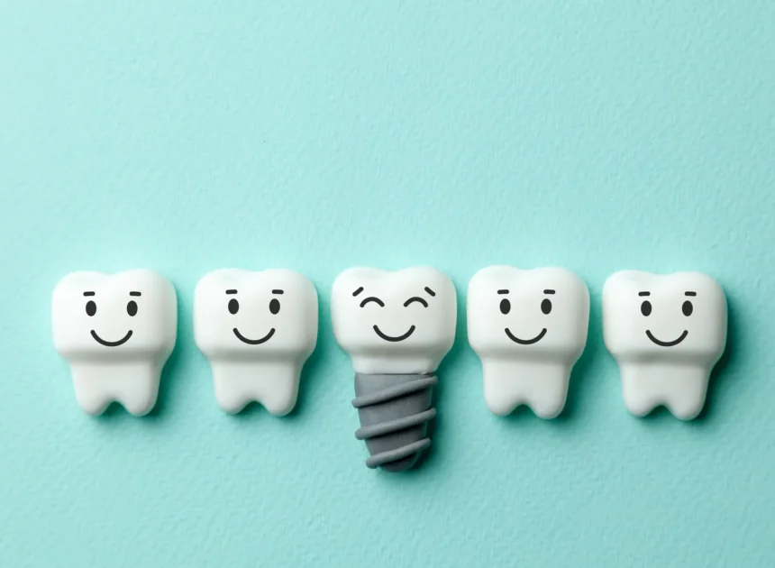 Czy warto zdecydować się na implanty zębowe?