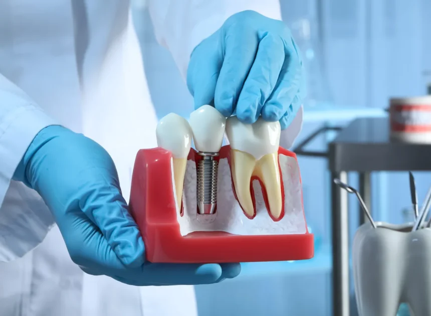 Implanty w jeden dzień Kołobrzeg