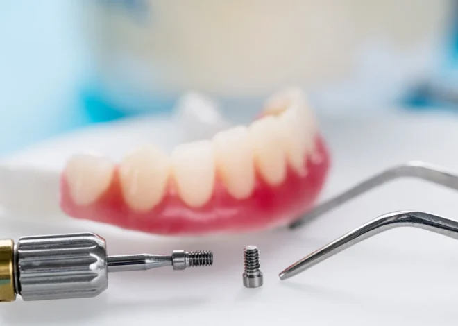 Implanty w jeden dzień Stargard