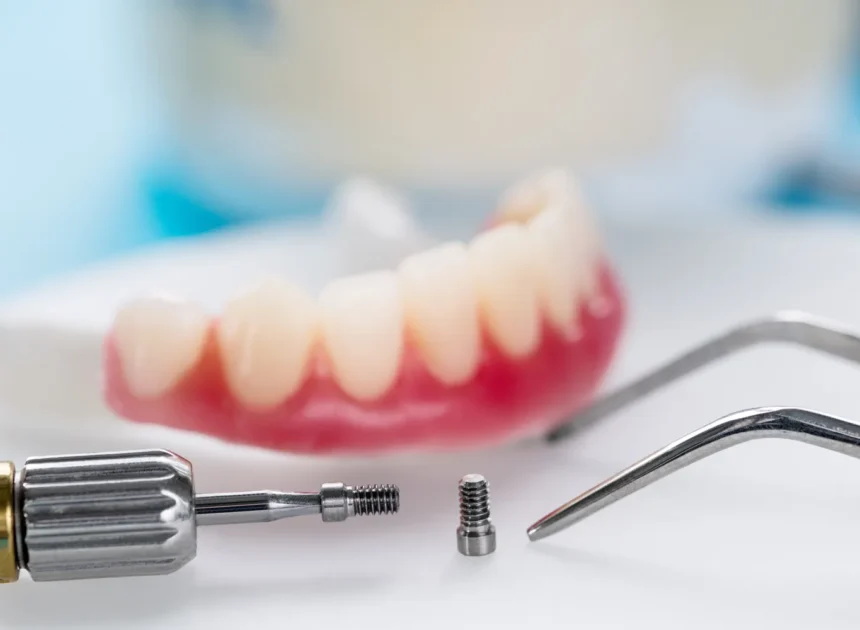 Implanty w jeden dzień Stargard