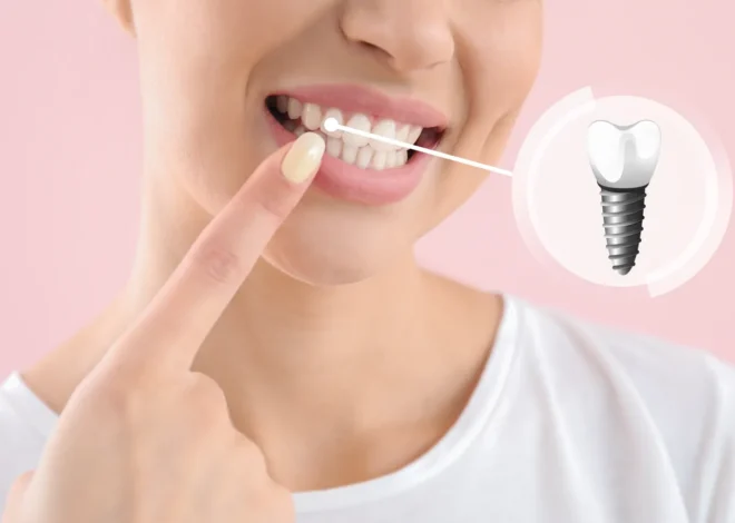 Implanty w jeden dzień Szczecin