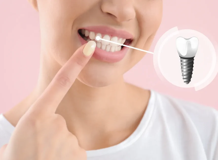 Implanty w jeden dzień Szczecin