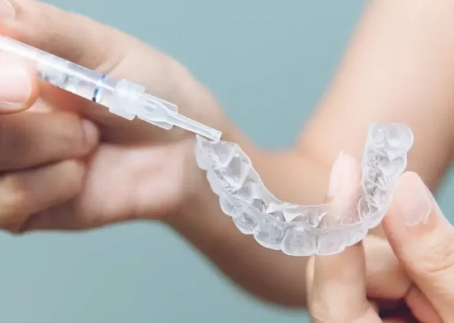 Invisalign kiedy efekty?