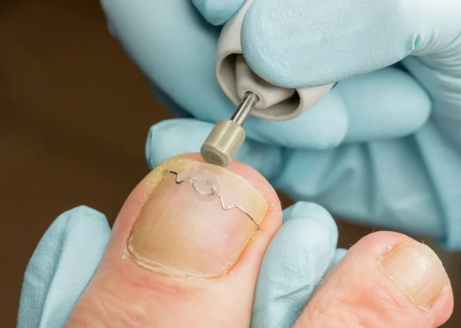 Pedicure leczniczy – co o nim wiedzieć warto?