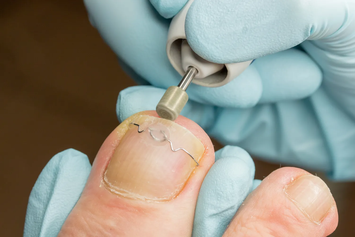 Pedicure leczniczy – co o nim wiedzieć warto?