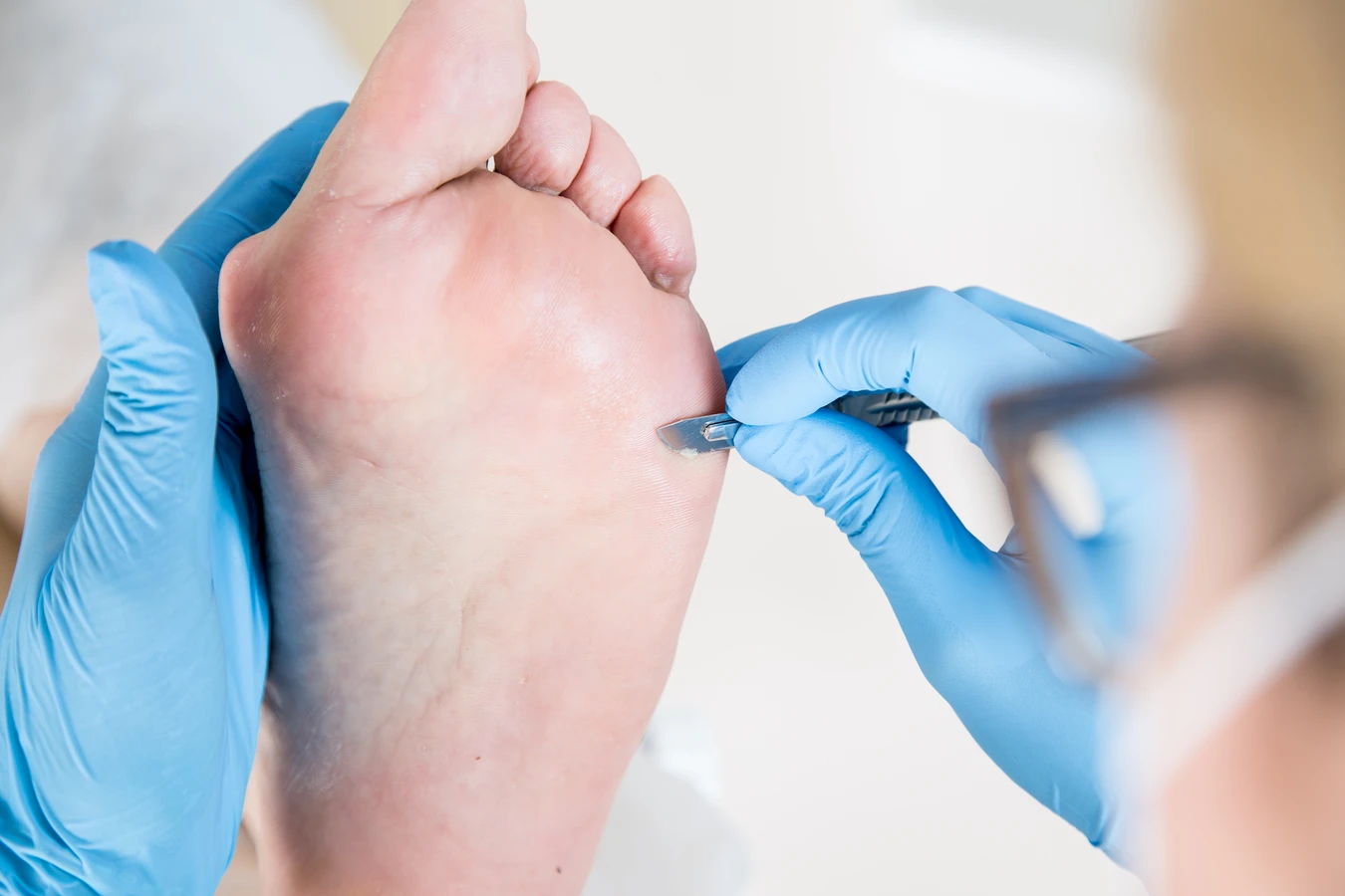 Podologia - czym jest i kiedy warto udać się do podologa?