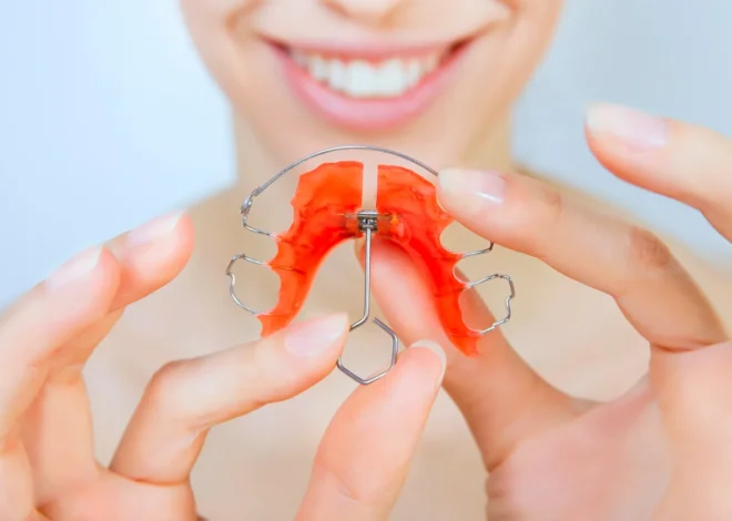 Ranking implantów zębowych – o tym warto wiedzieć