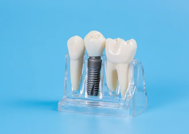 Zęby w jeden dzień Świnoujście