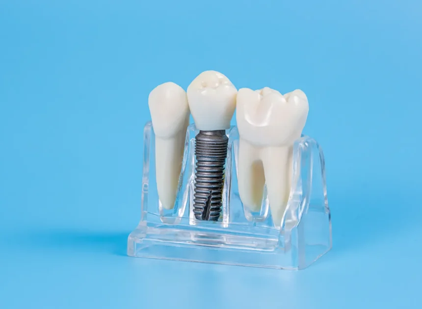 Zęby w jeden dzień Świnoujście