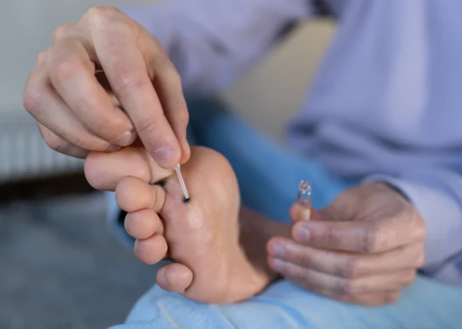 Jaskółcze ziele na kurzajki jak stosować?