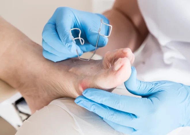 Najczęściej pojawiające się problemy podologiczne