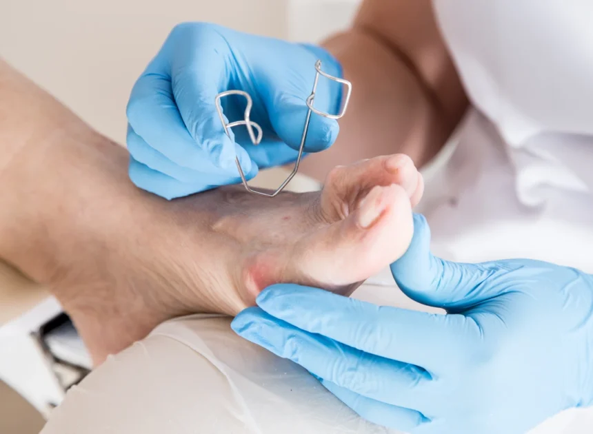 Najczęściej pojawiające się problemy podologiczne