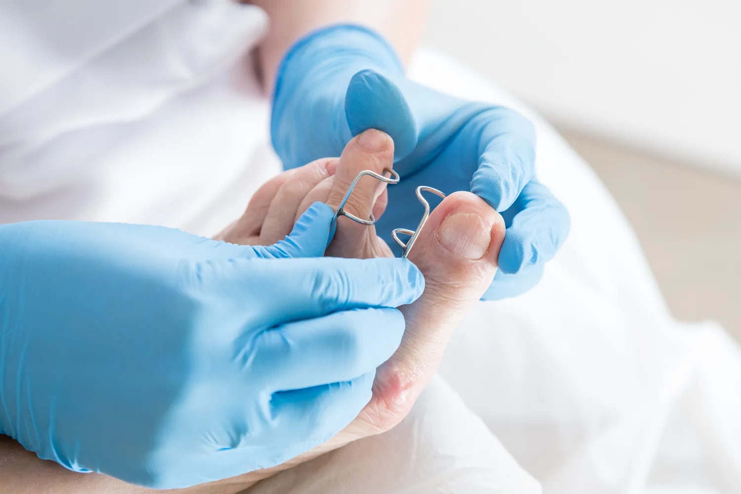 Pedicure leczniczy – co na ten temat wiedzieć trzeba?