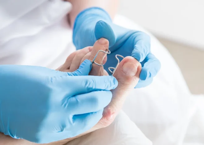 Podologia – sposób na zdrowe i piękne stopy