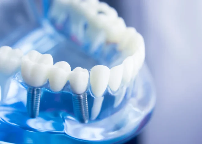 Zęby w jeden dzień Szczecin